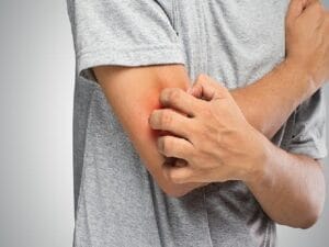 Mantar Hastalığı Hakkında Bilinmesi Gereken 6 Kıymetli Bilgi!