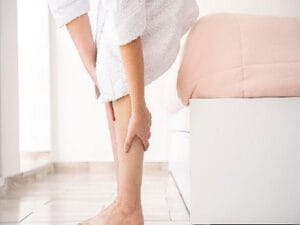 Yazın varis tedavisi olur mu?